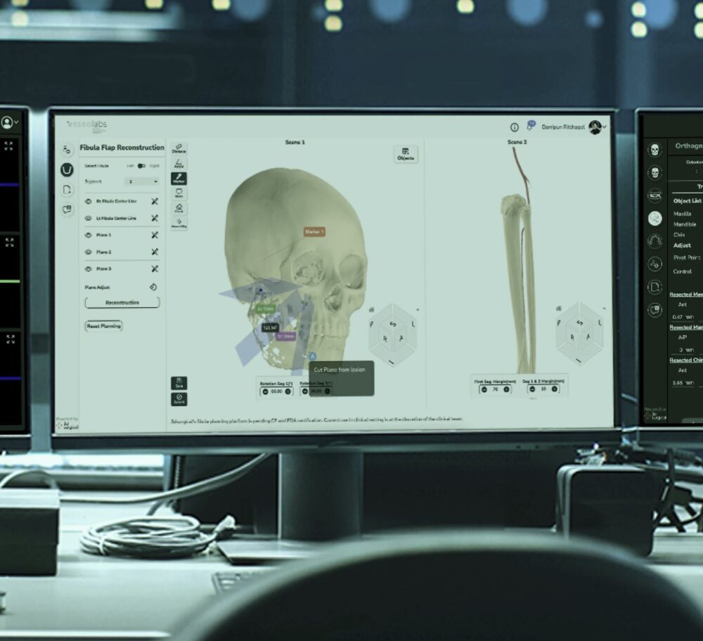 osseovision_unmatchedprecision-1000x912-1 Courtesy of OsseoLabs