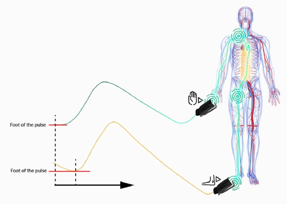 popmetre-axelife (Credit: Axelife)