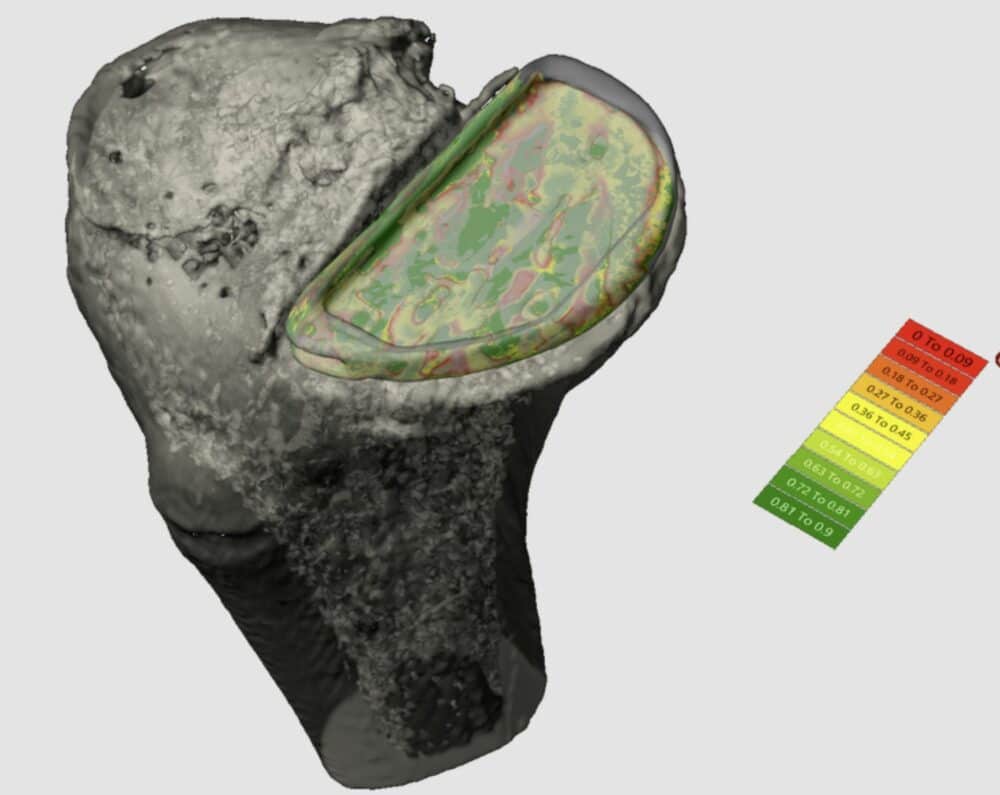 Vent Creativity: AI-Powered Surgical Planning